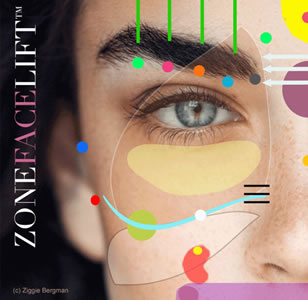 Zone Face Lift